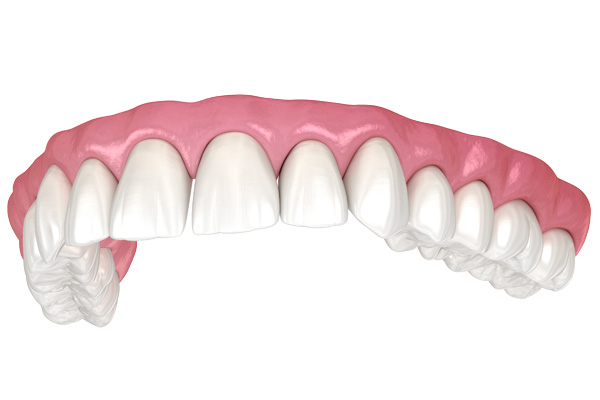 Dentures